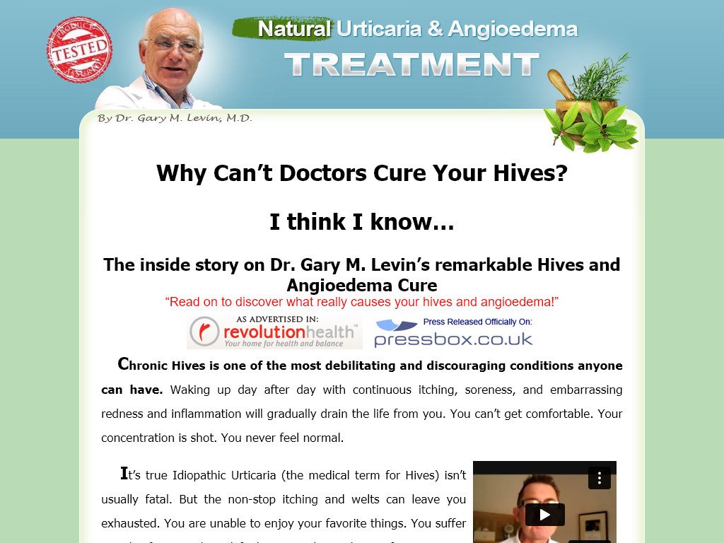 Urticaria & Angioedema Natural Treatment Sytem Review